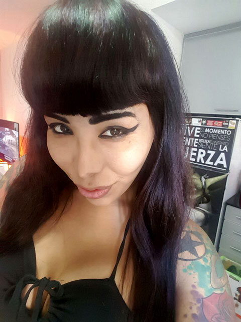 Cheek augmentation — cheek implants and lipofilling for facial feminization at T-Change Buenos Aires