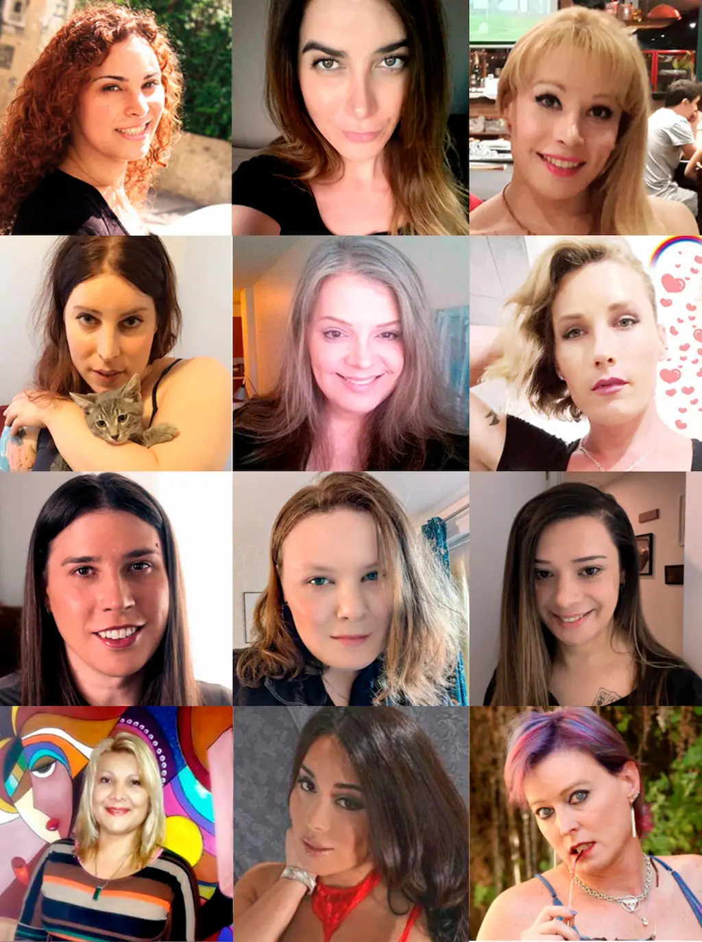 FFS before and after cases — T-Change Buenos Aires 20 years of facial feminization surgery